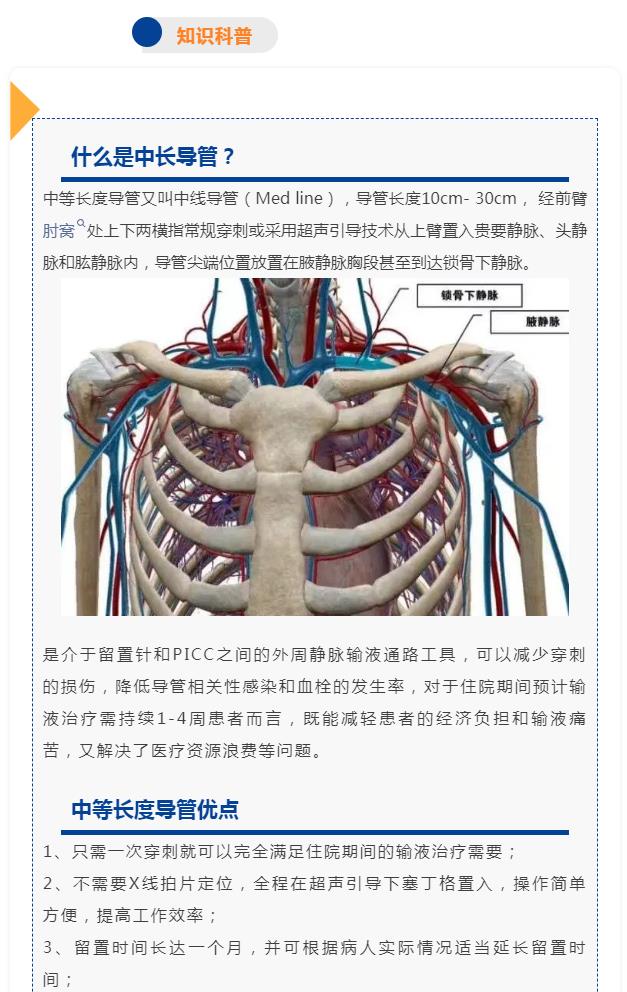 手臂上的“生命线”——中等长度导管置入术，为患者“减负”