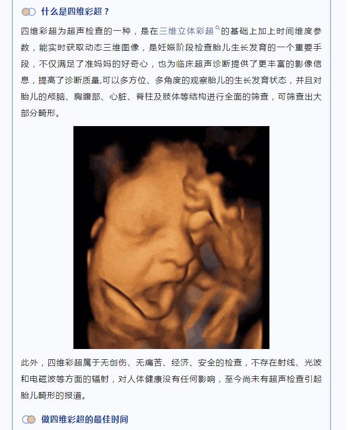 【超声医学科】关于胎儿四维彩超，您了解多少？