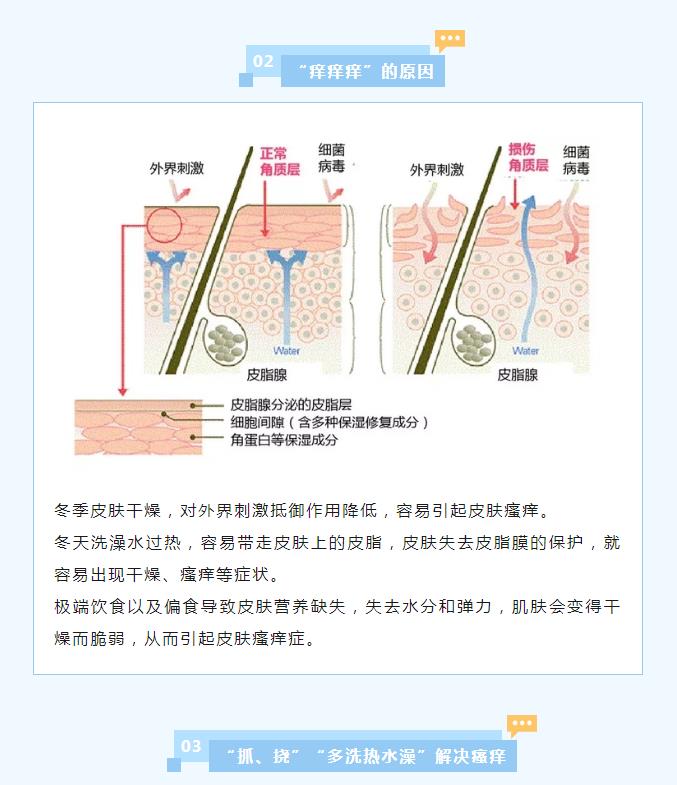 冬季皮肤瘙痒如何缓解？——我院皮肤科为您科普